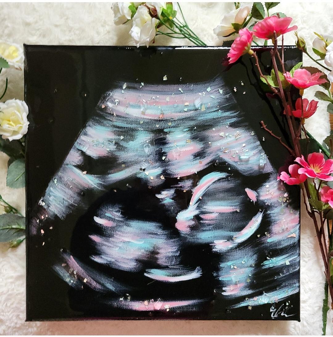 Custom Ultrasound Painting on Canvas w/Resin Finish & Embellishments Commission