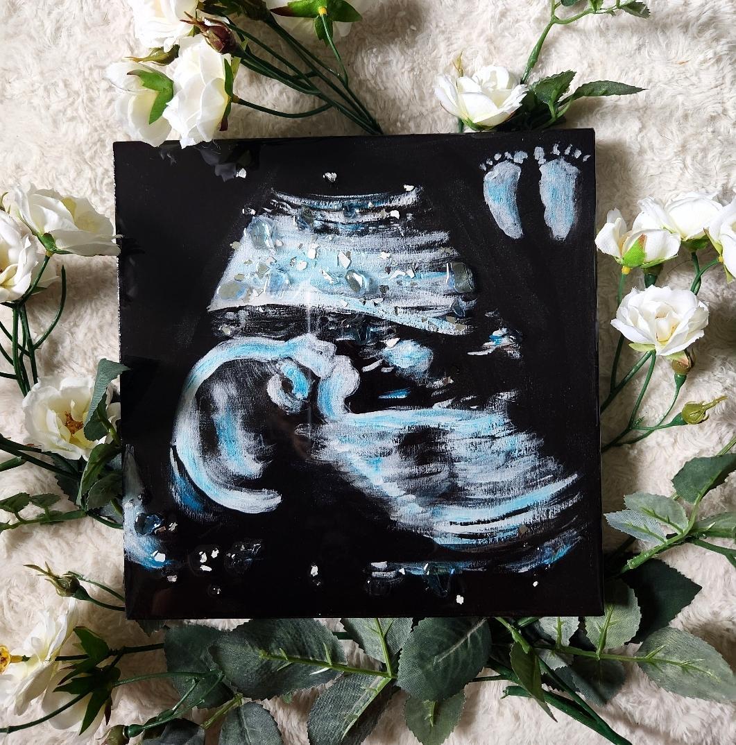 Custom Ultrasound Painting on Canvas w/Resin Finish & Embellishments Commission