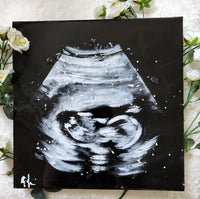 Custom Ultrasound Painting on Canvas w/Resin Finish & Embellishments Commission